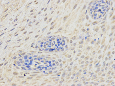Immunohistochemistry (Formalin/PFA-fixed paraffin-embedded sections) analysis of human esophagus tissue labelling ETV6 / Tel with ab185816 at 1/200. Magnification: 400x.