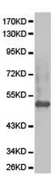 Anti-ETV6 / Tel antibody (ab185816) at 1/500 dilution + A431 cell line extracts