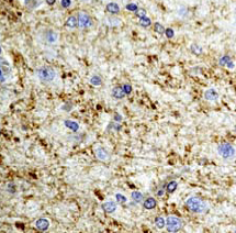 Ab54235, prediluted, staining CNPase in formalin fixed, paraffin embedded human brain tissue by immunohistochemistry.