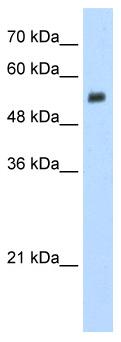 Anti-EVX2 antibody (ab56209) at 1.25 µg/ml + Jurkat cell lysate at 10 µgSecondaryHRP conjugated anti-Rabbit IgG at 1/50000 dilution