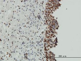 EWSR1 antibody (ab54708) used in immunohistochemistry at 3ug/ml on formalin fixed and paraffin embedded human urinary bladder.