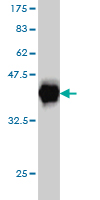 Western blot against tagged recombinant protein immunogen using ab54708 EWSR1 antibody at 1ug/ml.