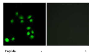 Immunofluorescence analysis of A549 cells using ab69874 at a 1/500 dilution.Left image un-treated.Right image treated with immunizing peptide.