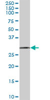 Anti-EXOSC3 antibody (ab67661) at 1/500 dilution + human pancreas tissue lysate at 25 µgSecondaryGoat Anti-Mouse IgG (H&L)-HRP Conjugate at 1/2500 dilution