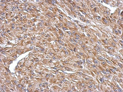 Immunohistochemical analysis of paraffin embedded U87 xenograft tissue labeling CPEB4 with ab155204 at 1/500 dilution.