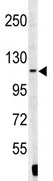 Anti-Exportin T antibody (ab85365) at 1/50 dilution + Ramos cell line lysates at 35 µg
