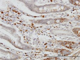 EY Cadherin antibody (ab54512) used in immunohistochemistry at 3ug/ml on formalin fixed and paraffin embedded human small Intestine.
