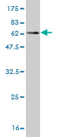 Western blot against tagged recombinant protein immunogen using ab57760 cPLA2 beta antibody at 1ug/ml.