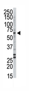 Anti-FACL4 antibody - Aminoterminal end (ab70937) at 1/100 dilution + 293 cell lysate at 12.5 µg
