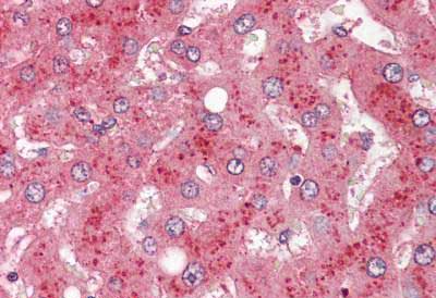 Immunohistochemical analysis of formalin-fixed, paraffin-embedded Human liver tissue labelling Factor B with ab150494 at 1/200 dilution.