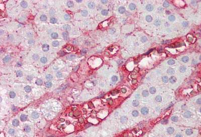 Immunohistochemical analysis of formalin-fixed, paraffin-embedded Human adrenal tissue labelling Factor B with ab150494 at 1/200 dilution.