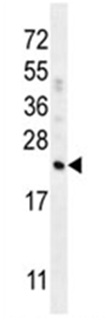 Anti-Factor D antibody (ab111204) at 1/100 dilution + A549 cell line lysates at 35 µg