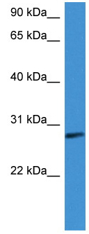 Anti-Factor D antibody (ab111880) at 1 µg/ml + Human Fetal Lung Lysate at 10 µg