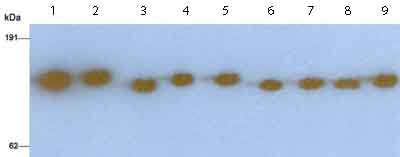 All lanes : Anti-Factor H antibody (ab8842) at 1/500 dilutionLane 1 : Purified Human Factor HLane 2 : Human serum sample (albumin depleted)Lane 3 : Mouse serum sample (albumin depleted)Lane 4 : Rat serum sample (albumin depleted)Lane 5 : Guinea pig serum sample (albumin depleted)Lane 6 : Cattle serum sample (albumin depleted)Lane 7 : Horse serum sample (albumin depleted)Lane 8 : Dog serum sample (albumin depleted)Lane 9 : Cat serum sample (albumin depleted)developed using the ECL techniquePerformed under non-reducing conditions.Image from Bhide MR et al, BMC Res Notes. 2009 Jul 15;2:134, Fig 1.
