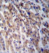 Immunohistochemical analysis of formalin fixed and paraffin embedded Human liver tissue labeling CPN1, using ab171323 at a 1/10 dilution, followed by peroxidase conjugation of the secondary antibody and DAB staining.