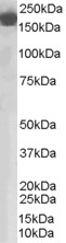 Anti-Factor H antibody (ab36134) at 0.03 µg/ml + A431 lysate (RIPA buffer, 30µg total protein per lane)