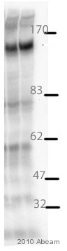 Anti-Factor H antibody (ab36134) at 1/2000 dilution + Human HepG2 whole cell lysate at 5 µgSecondaryAn HRP-conjugated donkey anti-goat IgG polyclonal at 1/2500 dilutiondeveloped using the ECL techniquePerformed under reducing conditions.