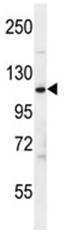 Anti-Factor H antibody (ab106974) at 1/100 dilution + K562 cell line lysate at 35 µg