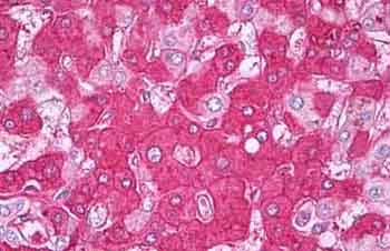 Immunohistochemical analysis of Formalin-fixed, Paraffin-embedded Human Liver tissue labelling Factor H with ab134829 at 5 µg/ml.