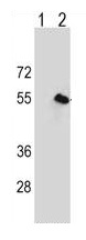 All lanes : Anti-CPN1 antibody (ab171323) at 1/50 dilutionLane 1 : 293 cell lysateLane 2 : 293 cell lysate transiently transfected with the CPN1 geneLysates/proteins at 2 µg per lane.