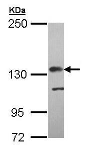 Anti-Factor H antibody (ab97519) at 1/5000 dilution + MOLT4 whole cell lysate at 30 µg