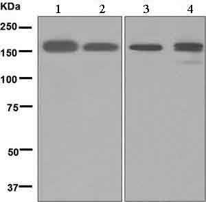 All lanes : Anti-Factor H antibody [EPR6225] (ab133536) at 1/1000 dilutionLane 1 : Human plasma lysateLane 2 : Human kidney lysateLane 3 : Human fetal lung lysateLane 4 : Human fetal liver lysateLysates/proteins at 10 µg per lane.SecondaryHRP labelled goat anti-rabbit at 1/2000 dilution