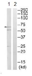 All lanes : Anti-Factor I antibody (ab110060) at 1/500 dilutionLane 1 : Jurkat cell lysateLane 2 : Jurkat cell lysate with immunizing peptide at 10 µgLysates/proteins at 30 µg per lane.