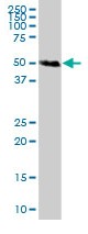Anti-Factor I antibody (ab90546) at 1 µg/ml + Human kidney lysate at 50 µg