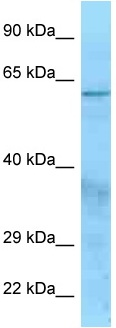 Anti-Factor I antibody (ab125440) at 1 µg/ml + HeLa cell lysate at 10 µg
