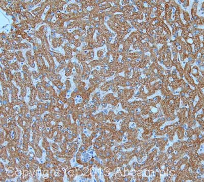 IHC image of Factor IX staining in human liver formalin fixed paraffin embedded tissue section, performed on a Leica Bond system using the standard protocol F. The section was pre-treated using heat mediated antigen retrieval with sodium citrate buffer (pH6, epitope retrieval solution 1) for 20 mins. The section was then incubated with ab97619, 1µg/ml, for 15 mins at room temperature and detected using an HRP conjugated compact polymer system. DAB was used as the chromogen. The section was then counterstained with haematoxylin and mounted with DPX.For other IHC staining systems (automated and non-automated) customers should optimize variable parameters such as antigen retrieval conditions, primary antibody concentration and antibody incubation times.