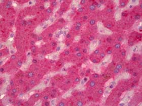 ab128038, at a concentration of 5 µg/ml, staining Factor IX in paraffin-embedded Human liver tissue by Immunohistochemistry.