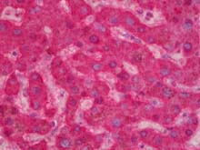 ab128048, at a concentration of 2.5 µg/ml, staining Factor IX in paraffin-embedded Human liver tissue by Immunohistochemistry.