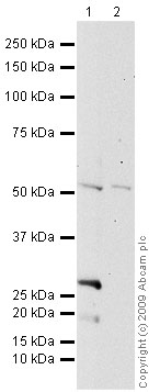 All lanes : Anti-Factor IX antibody [13B9] (ab17197) at 5 µg/mlLane 1 : Liver (Human) Tissue Lysate - adult normal tissue (ab29889)Lane 2 : HepG2 (Human hepatocellular liver carcinoma cell line) Whole Cell Lysate Lysates/proteins at 10 µg per lane.SecondaryGoat polyclonal to Mouse IgG - H&L - Pre-Adsorbed (HRP) at 1/3000 dilution