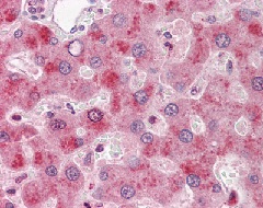 ab125149, at 10µg/ml, staining Factor IX in formalin-fixed, paraffin-embedded Human liver tissue by Immunohistochemistry.