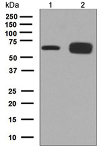 All lanes : Anti-Factor IX antibody [EPR6187] (ab124815) at 1/1000 dilutionLane 1 : HepG2 cell lysate Lane 2 : Human plasma Lysates/proteins at 10 µg per lane.