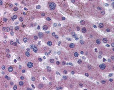 ab104564, at 5 ug/ml, staining Factor VII in formalin-fixed, paraffin-embedded Human Liver by Immunohistochemistry, using a biotinylated secondary antibody, alkaline phosphatase-streptavidin and chromogen.