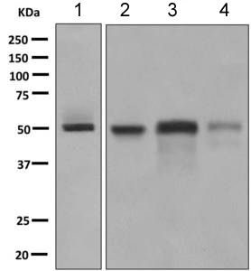 All lanes : Anti-Factor VII antibody [EP6185(2)] (ab151543) at 1/1000 dilutionLane 1 : Human placenta lysateLane 2 : Human serum lysateLane 3 : Human fetal liver lysateLane 4 : HepG2 cell lysateLysates/proteins at 10 µg per lane.SecondaryGoat anti-rabbit HRP at 1/2000 dilution