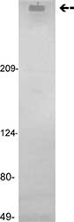Anti-Factor VIII antibody [GMA-012] (ab78852) at 1 µg/ml + human Factor VIII at 2 µgSecondaryGoat anti-mouse HRP conjugated IgG