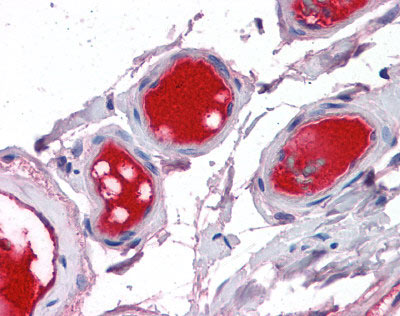 ab110138, at 5 µg/ml, staining F10 in vessels in Human small intestine by immunohistochemistry.