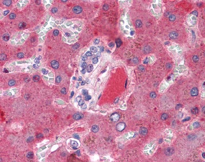 ab110138, at 5 µg/ml, staining a vessel in Human liver by immunohistochemistry.