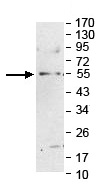 Anti-Factor X antibody (ab140112) at 1/500 dilution + Human fetal kidney lysate