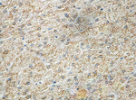 Immunohistochemical analysis of formalin-fixed, paraffin-embedded Human fetal liver labelling Factor X with ab140112 at 1/100.