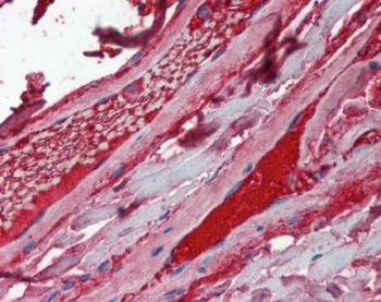 ab124289, at 5 µg/ml, staining Factor Xa Heavy Chain in paraffin embedded Human vessels by Immunohistochemistry.