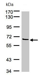 Anti-Factor XI antibody (ab97346) at 1/1000 dilution + 293T whole cell lysate at 30 µg