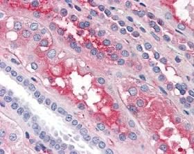 Human Kidney (formalin-fixed, paraffin-embedded) stained with ab104557 at 5 µg/ml followed by biotinylated anti-goat IgG secondary antibody, alkaline phosphatase-streptavidin and chromogen.