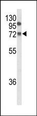 Anti-Factor XII antibody (ab103009) at 1/100 dilution + MDA-MB435 cell line lysates at 35 µg