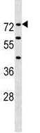 Anti-Factor XII antibody - N-terminal (ab139093) at 1/100 dilution + NCI-H292 cell line lysate at 35 µg