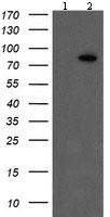 All lanes : Anti-Factor XIII/XIIIa antibody [9E2] (ab131646) at 1/2000 dilutionLane 1 : HEK293T cells transfected with pCMV6-ENTRY control cDNALane 2 : HEK293T cells transfected with pCMV6-ENTRY Factor XIII/XIIIa cDNA Lysates/proteins at 5 µg per lane.