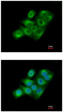 Immunofluorescence analysis of paraformaldehyde-fixed A549, using ab97636 at 1/200 dilution. Lower image is merged with DNA probe.