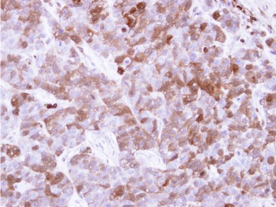 Immunohistochemical analysis of paraffin-embedded H520 xenograft, using ab97636 at 1/500 dilution.